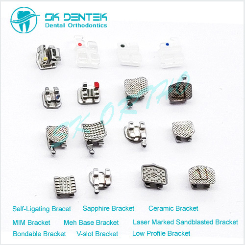 Orthodontic Brace Series 